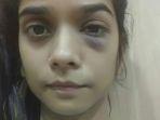 preksha-mehta-bunuh-diri.jpg