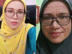 wanita-mendadak-wajahnya-penuh-keriput-setelah-melahirkan.jpg