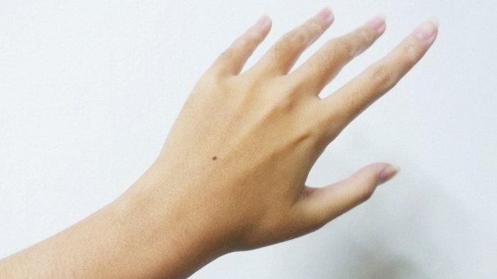 Arti Tahi Lalat di Punggung Tangan Menurut Primbon Jawa, Konon Pandai Atur Uang