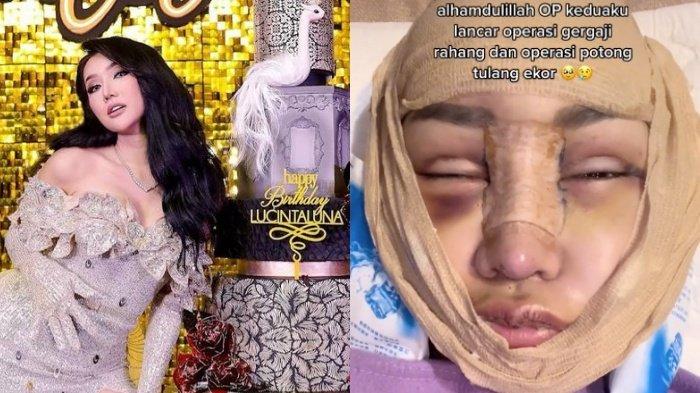 BEAUTY is Pain, Lucinta Luna Sampai Rela Potong Jakun Biar Jadi Perempuan Utuh