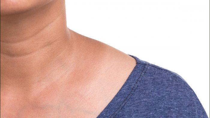 Arti Kedutan di Leher Bagian Kanan, Berhati-Hatilah