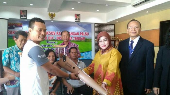 AYUB Berikan Bantuan Kaki Tangan Palsu bagi Tuna Daksa