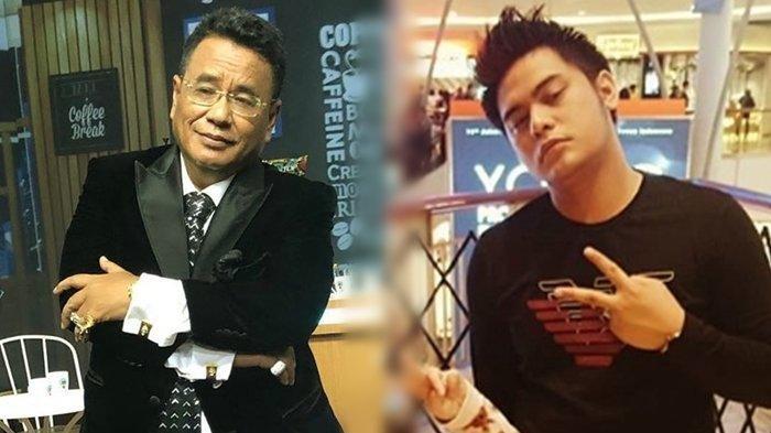 Hotman Paris Saling Sindir dengan Galih Ginanjar di Instagram