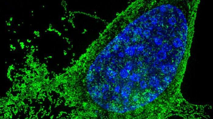 Modifikasi Gen untuk Pertama Kalinya Sembuhkan HIV pada Hewan Hidup
