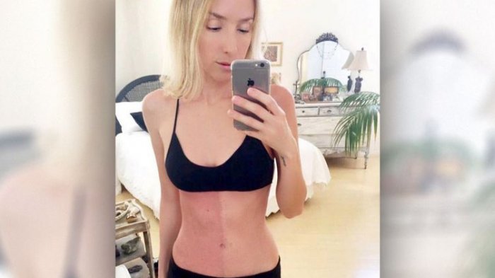 Perempuan Ini Miliki Kembaran yang Ada dalam Dirinya