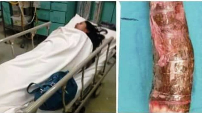 Wanita Ini Suka yang Herbal, Dia Gunakan Singkong untuk Alat Mainan Seks! Akhirnya Malah Fatal