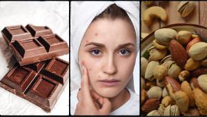 jerawat-cokelat-dan-kacang.jpg