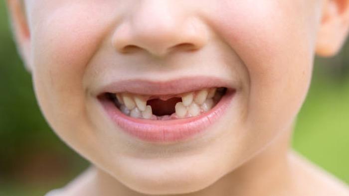 Mimpi gigi atas copot sebelah kiri dalam primbon jawa