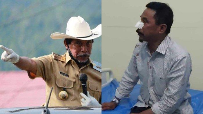 Kronologi-Pengusaha-Tambang-Gigit-Hidung-Mantan-Bupati-Boltim-Hingga-Putus-Dipicu-Masalah-Utang.jpg