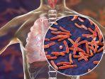 Gejala-dan-Cara-Penularan-Penyakit-Tuberkulosis.jpg