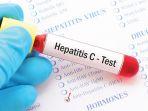 Gejala-dan-penyebab-hepatitis-c-atau-penyakit-kuning.jpg