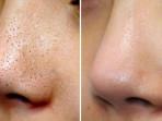 Tips dan Rekomendasi Skincare Routine untuk Mengecilkan Pori-Pori Besar