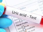 asam-urat-atau-uric-acid.jpg