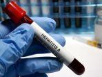 ilustrasi-hepatitis-a-ist-istock.jpg
