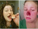 marisa-dotson-harus-rela-kehilangan-hidung3_20170805_084346.jpg