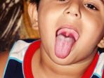 uvula_2_20171122_184452.jpg
