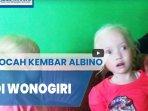 viral-bocah-kembar-albino-ibu-kandung-tahu-tahu-pas-lahir-rambutnya-putih.jpg