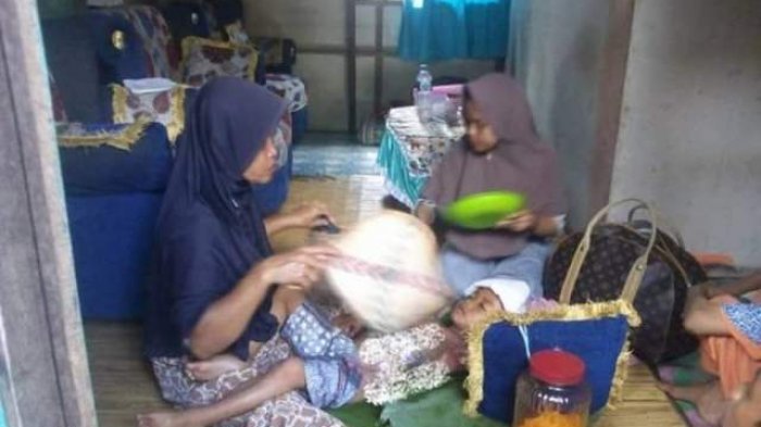 Bocah 5 Tahun Alami Luka Bakar dari Ledakan yang Terjadi Saat Mengais Sampah