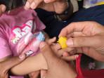 telunjuk-bocah-terjepit-mainan-di-kotim.jpg