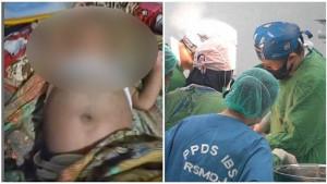20231027_Operasi-tumor-bayi-yang-sempat-viral-disebut-hamil.jpg