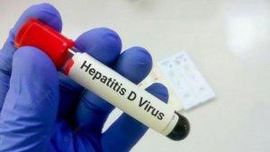 Misterius-Benarkah-Hepatitis-Akut-Dampak-Long-Covid-19-Ini-Fakta-Hasil-Tes-PCR-dan-Hipotesa-Ahli.jpg