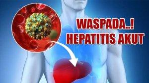 Waspada-Hepatitis-Akut.jpg