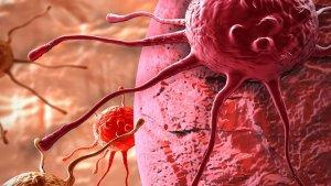 ilustrasi-sel-kanker-2.jpg