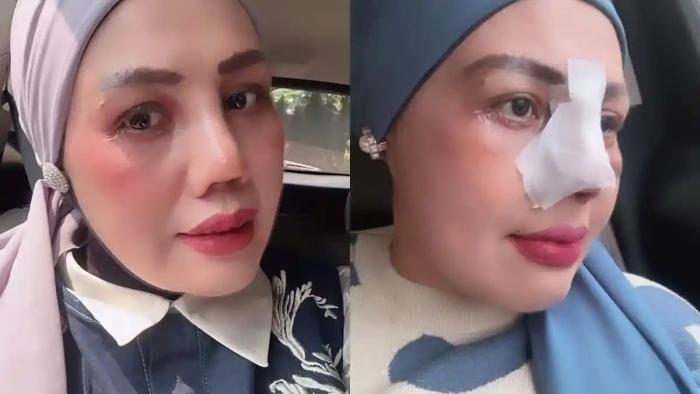 Pangling dengan Dirinya Sendiri usai Operasi Plastik, Elly Sugigi Akui Mirip Ayu Azhari - Tribunkaltim.co