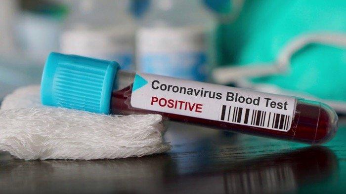 UPDATE Virus Corona di Penajam Paser Utara, Hari Natal Ketambahan 6 Kasus Positif Covid-19