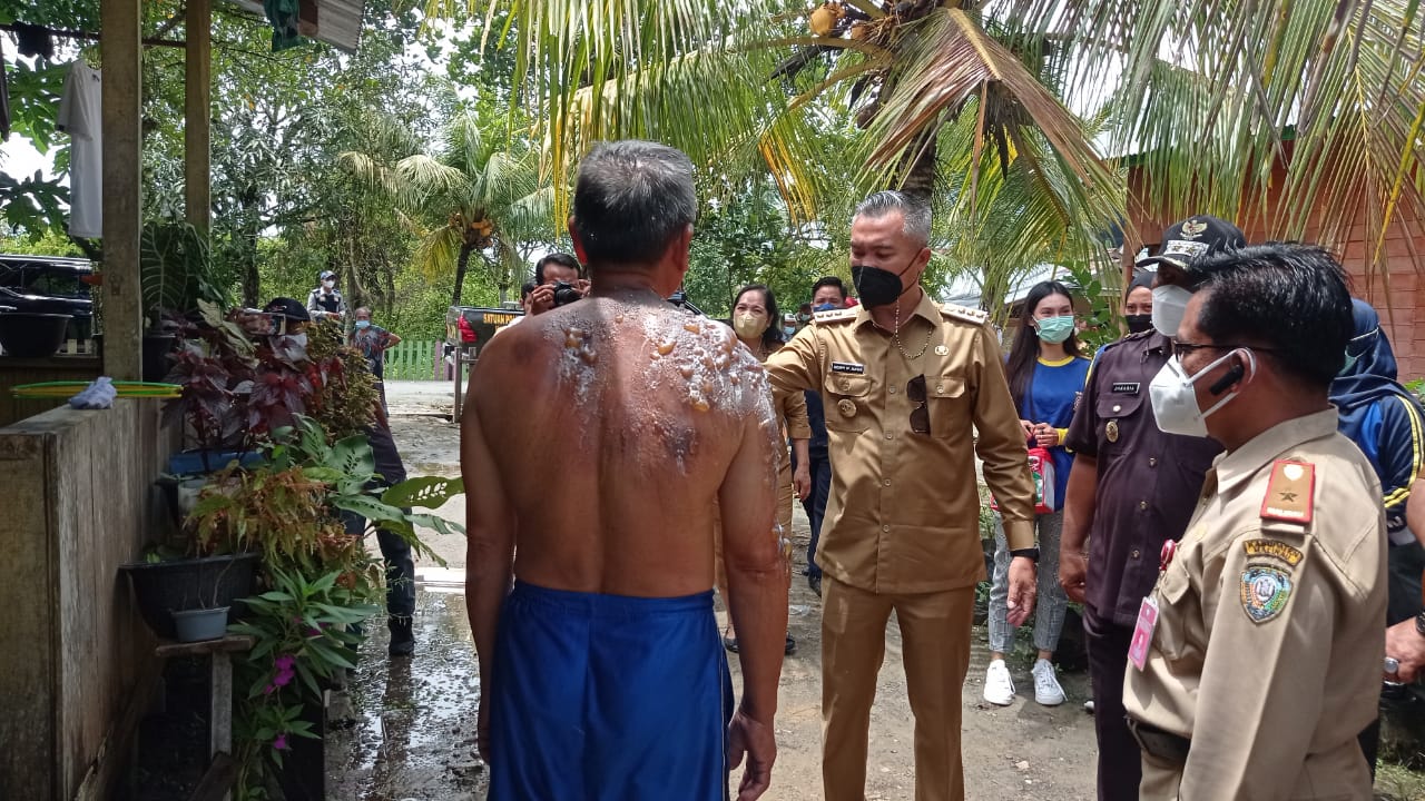 Selamatkan Surat-surat Berharga, Dua Warga Desa Malinau Hilir Alami Luka Bakar