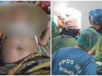 20231027_Operasi-tumor-bayi-yang-sempat-viral-disebut-hamil.jpg