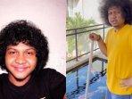 20240409_Isi-Permintaan-Maaf-Babe-Cabita_anemia-aplastik_auto-imun.jpg