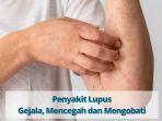 Apakah-Penyakit-Lupus-Bisa-Disembuhkan-Ketahui-Penjelasan-Penyebab-hingga-Pengobatannya.jpg