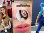 Lucinta-Luna-Pamer-Hasil-Operasi-Terbaru-di-Busan-Sebut-Bibirnya-sudah-Mirip-Jisoo-BLACKPINK.jpg