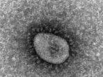 Varian-omicron-dari-coronavirus-seperti-hasil-pengamatan-dari-mikroskop.jpg