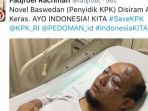 novel-baswedan-disiram-air-keras_20170411_092450.jpg