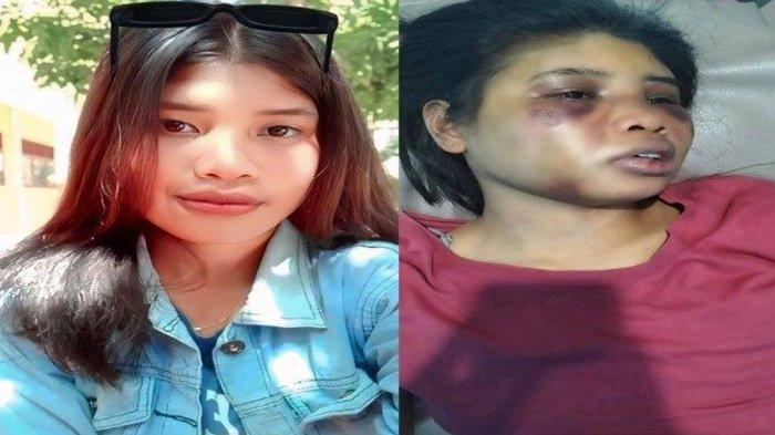 Viral NTT, Orang Tua Intan Tak Kenali Wajah Putrinya Usai Dihajar Majikan di Batam, Sang Ibu Kalut