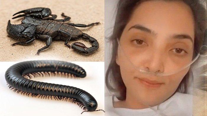 Wajah Ashanty Dirayapi Kalajengking dan Kaki Seribu, Ini Kata Anak Indigo, Istri Anang Diguna-guna?