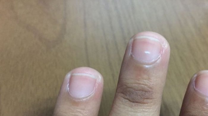 Soleman Dethan: Saya Tidak Takut Hadapi Proses Kasus Amoral