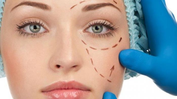 Wanita di China Lakukan Operasi Wajah untuk Mengelabui Penagih Hutang, Simak Kisahnya