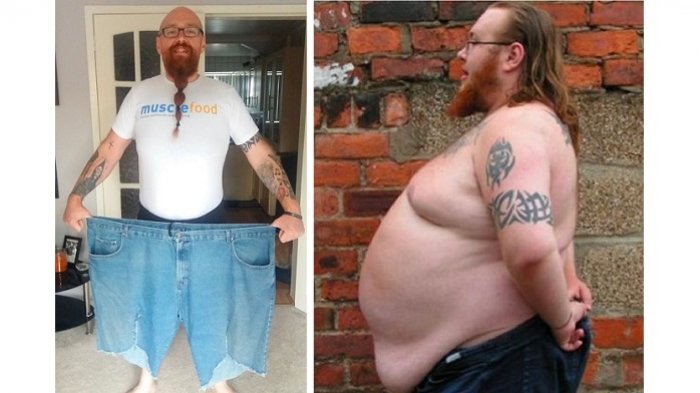 Berhasil Turunkan Berat Badannya hingga 65 Kilogram, Pria Ini Hadapi Masalah Baru, Malah Makin Malu