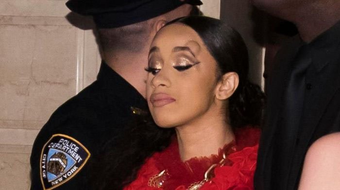 Sempat Lempar Sepatu ke Nicki Minaj, Pelipis Cardi B Malah Benjol! Apa Penyebabnya?