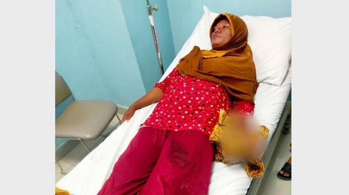 Warga Pulau Rinca Labuan Bajo Digigit Komodo, BTNK Sebut Murni Kecelakaan