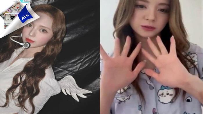 Diduga Alami Kekerasan, Mashiro MADEIN Muncul dengan Memar di Tubuhny, Netizen : Usut Tuntas