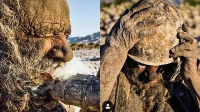 Gegara Tak Mandi Selama 67 Tahun, Kakek Ini Dijuluki Manusia Terkotor di Dunia, Kulitnya Jadi Begini