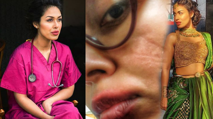 Dokter Cantik Ini Rela Wajahnya Rusak, Berjam-jam Pakai Masker, Ternyata Ratu Kecantikan Tahun 2019