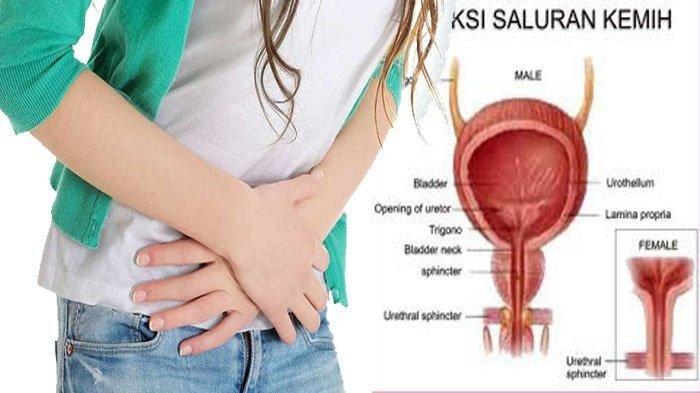 Hai Wanita, Inilah 3 Gejala Penyakit Infeksi Saluran Kencing atau ISK yang Jarang Diketahui, Apa?
