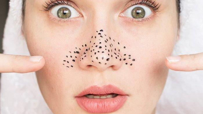 Tips Cantik, Simak 3 Cara Mudah Hilangkan Komedo di Hidung, Bersih Tuntas!