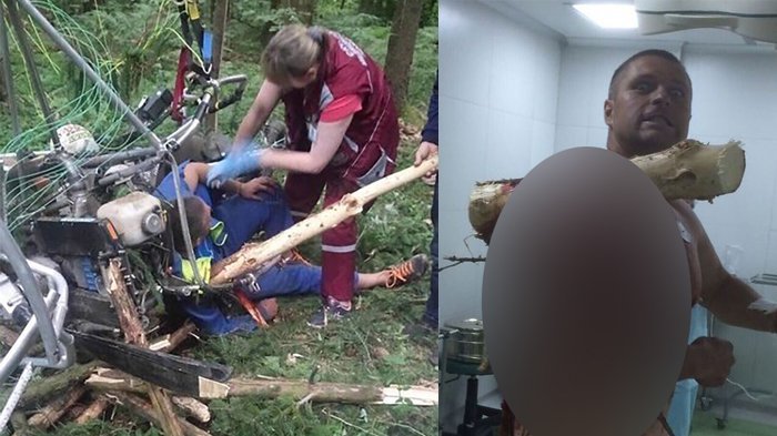 Batang Pohon Besar Tembus Bahunya, Pilot Ivan Krasouski Ini Masih Becanda Bilang I am Groot!