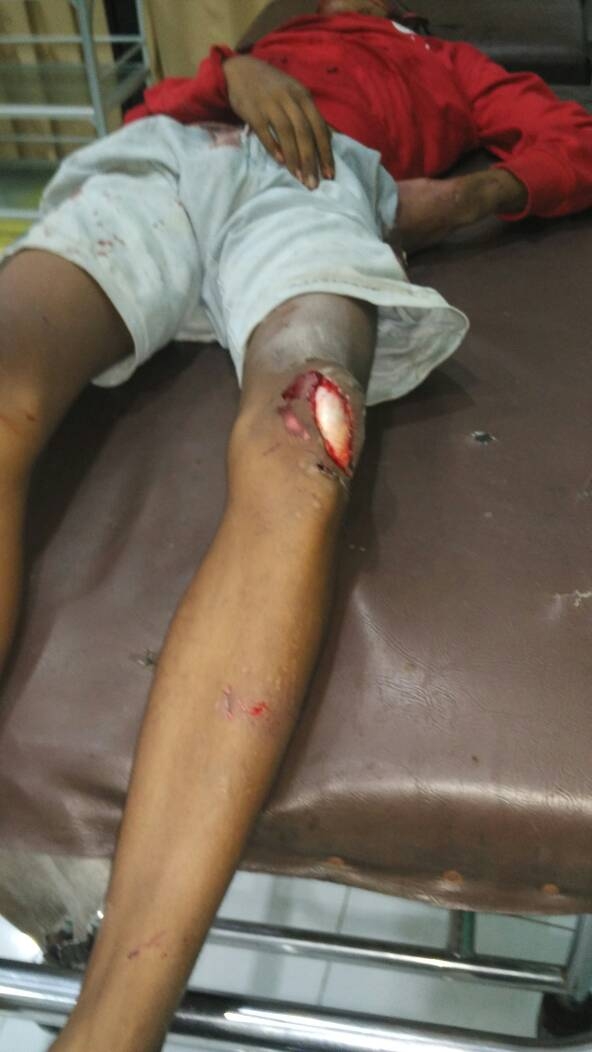 19 Orang Tewas akibat Kecelakaan